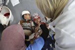 España propone coordinarse para traer niños enfermos de Gaza